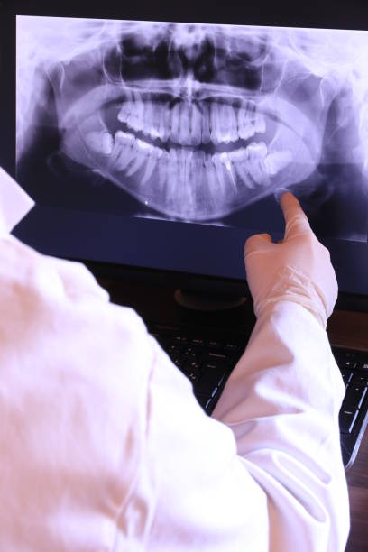 Best Emergency Wisdom Teeth Removal in Port Lavaca, TX